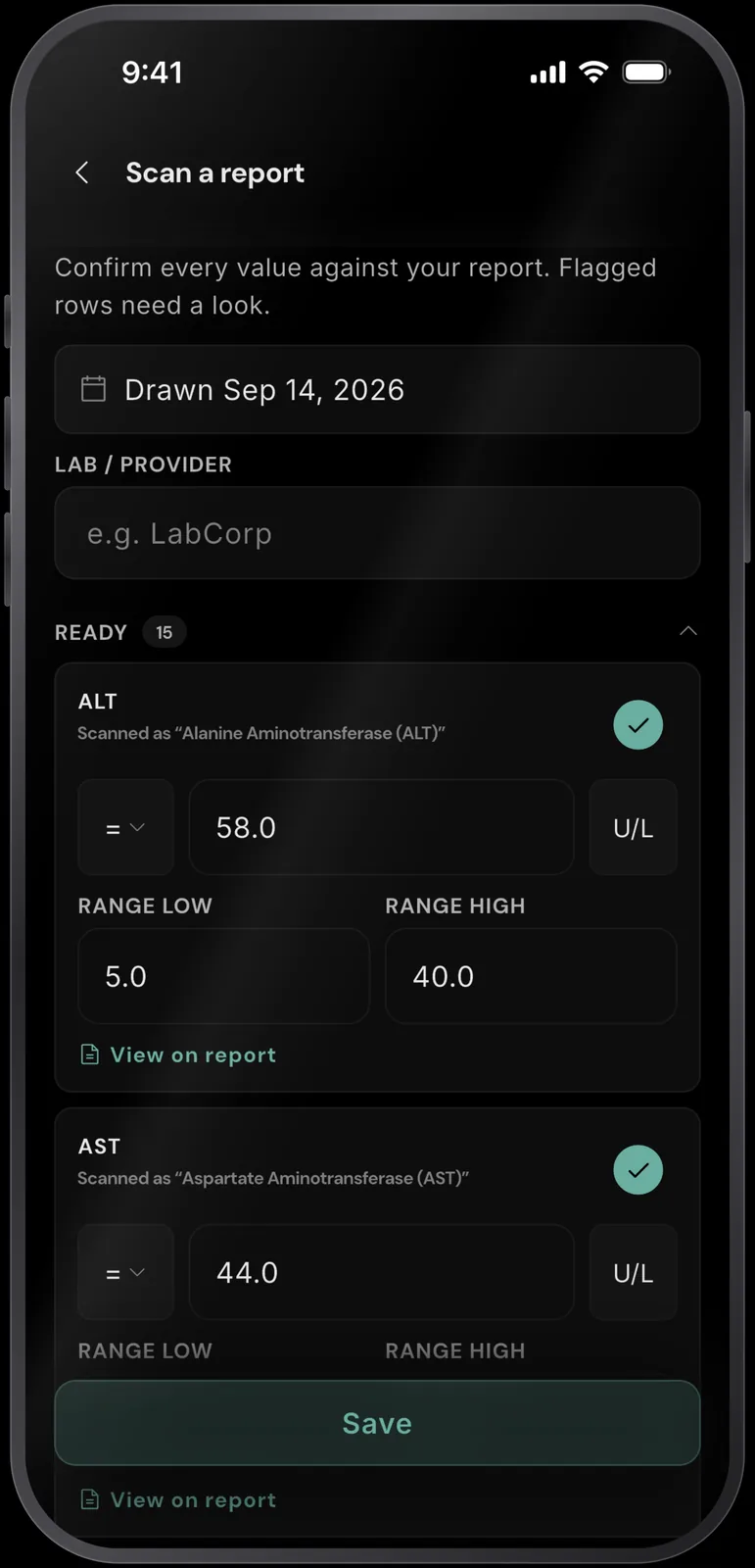 RESISTX import review of a sample lab report: 15 markers read and ready, ALT matched from the text “Alanine Aminotransferase (ALT)” at 58.0 U/L with its 5 to 40 reference range, each row carrying a View on report link.
